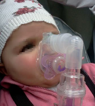 Researchers from the Technion Developed Inhalation Mask for Infants